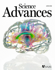The brain-penetrant clinical ATM inhibitor AZD1390 radiosensitizes and improves survival of preclinical brain tumor models